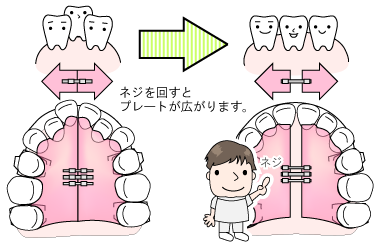 shikumi